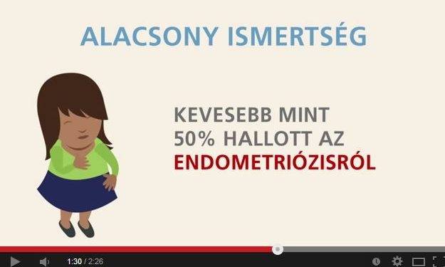 Tudj meg többet az endometriózisról! – programajánló és videó