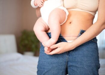 Szétnyílt hasizom? LoveYourBelly!